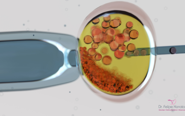 Fertilização in Vitro