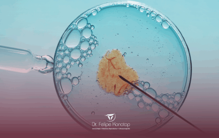 Inseminação artificial